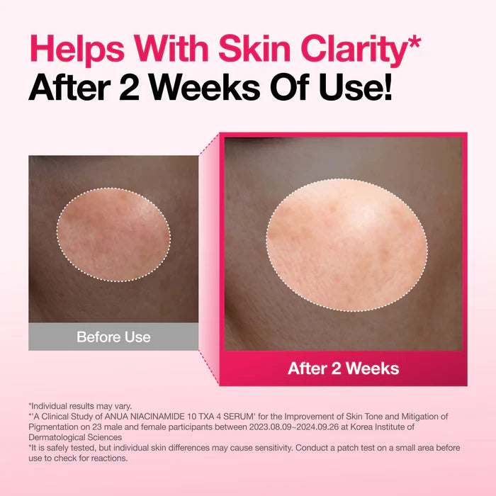ANUA Niacinamide 10% TXA 4% Serum | Dark Spots Serum