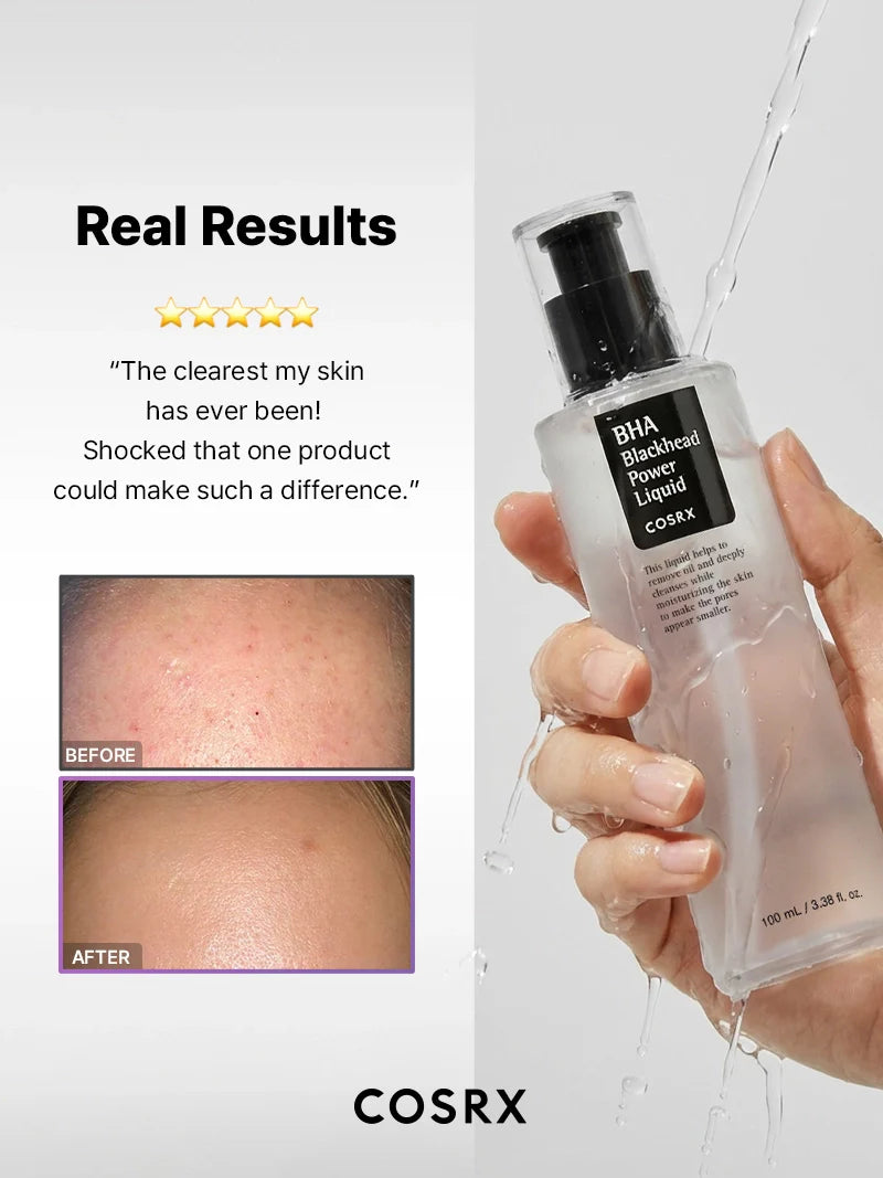 COSRX Niacinamide 2% + BHA 4% Blackhead Exfoliant Toner
