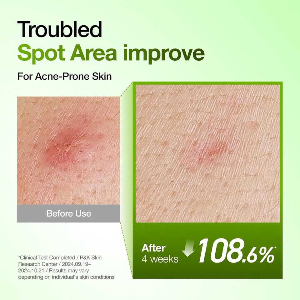 ANUA Azelaic Acid 10 Serum