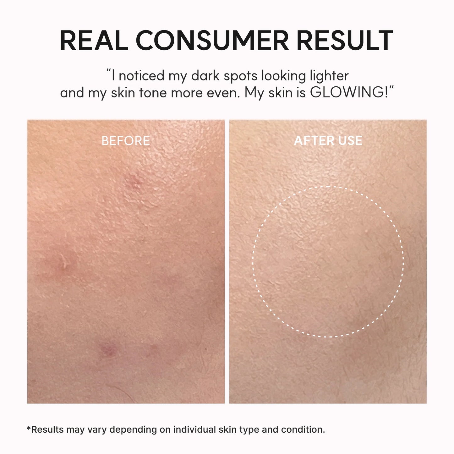 Arencia TXA Booster Shot Serum