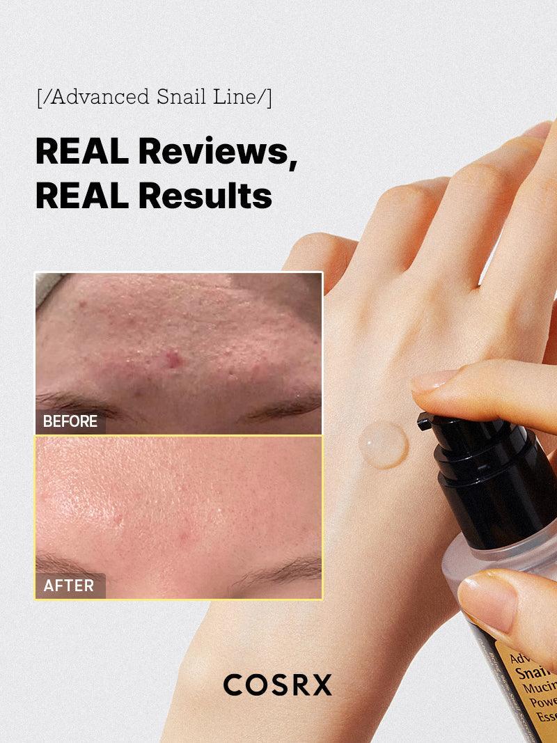 COSRX Advanced Snail 96 Mucin Power Essence Serum