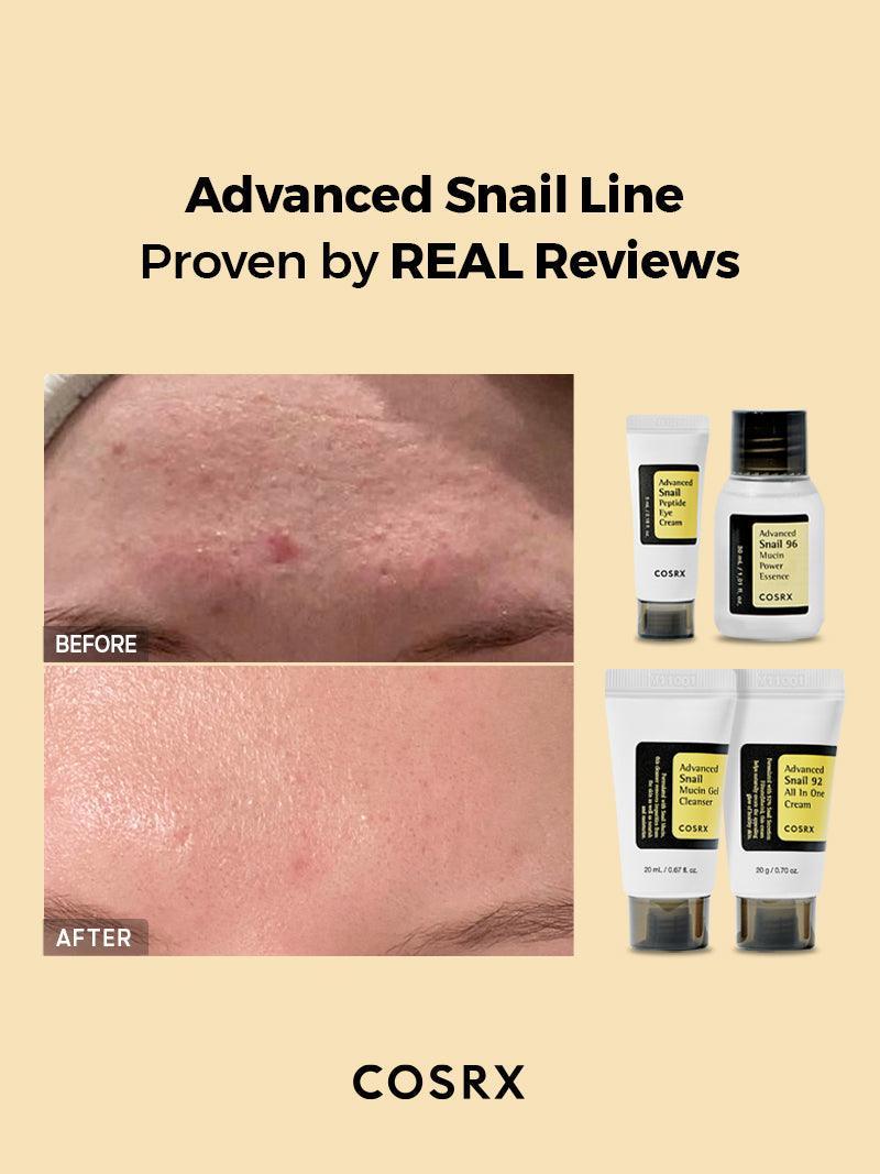 COSRX All About Snail Kit | 4-Step Snail Mucin Skincare Set